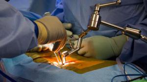 Гигантские почки удалили с помощью лапароскопии российские хирурги