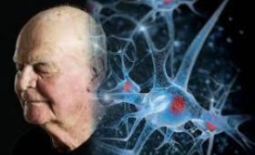 Эксперты назвали причины преждевременного старения мозга