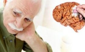 После рака снижается риск болезни Альцгеймера — медики