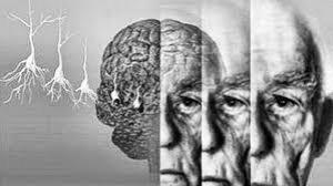 Исследование: гипертония и диабет не связаны с болезнью Альцгеймера